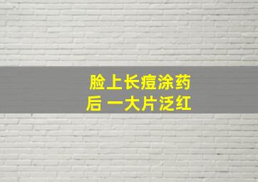 脸上长痘涂药后 一大片泛红